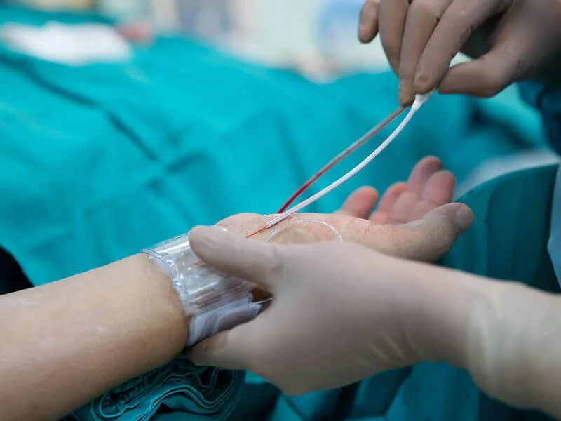 Angiography at Draupadi Devi Memorial Hospital