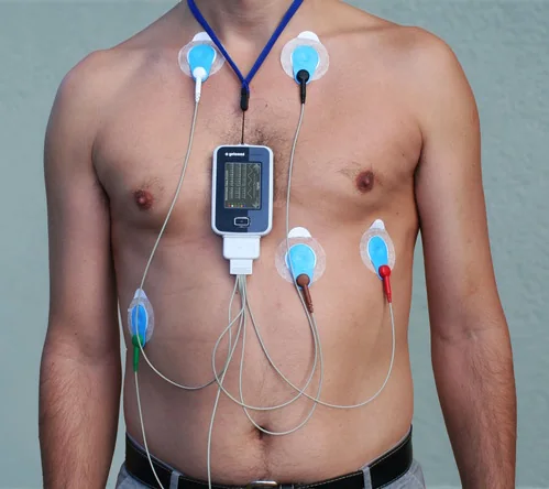 Holter Monitoring at Draupadi Devi Memorial Hospital