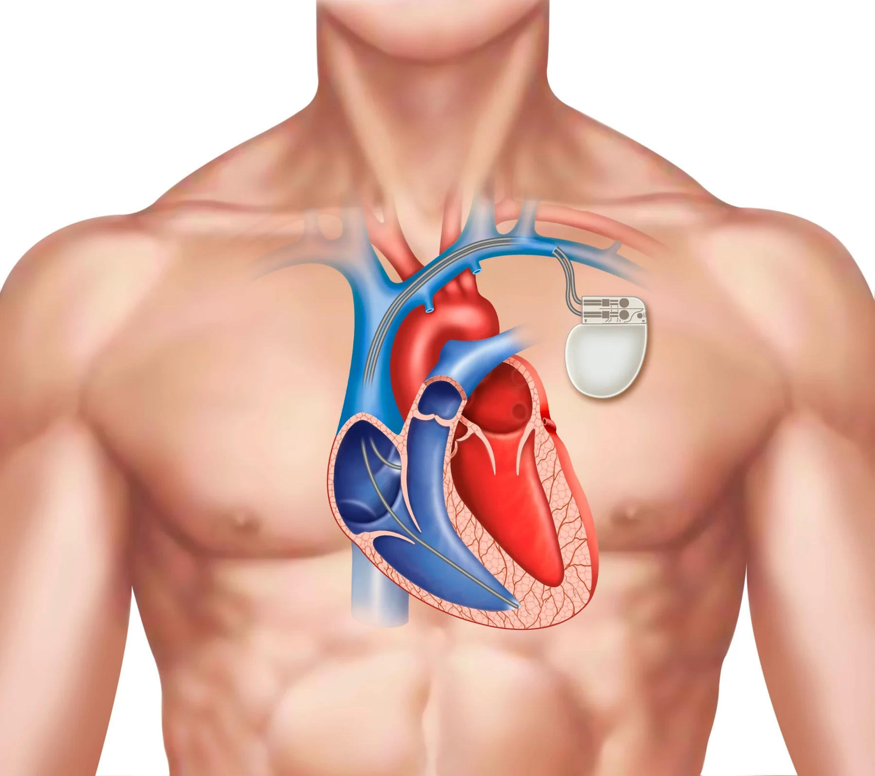 Pacemaker & Device Care at Draupadi Devi Memorial Hospital